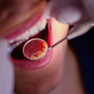 Россиян предупредили о неожиданном последствии проблем с зубами